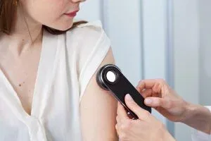 dermatoscopia cancer de pele