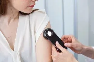 dermatoscopia cancer de pele